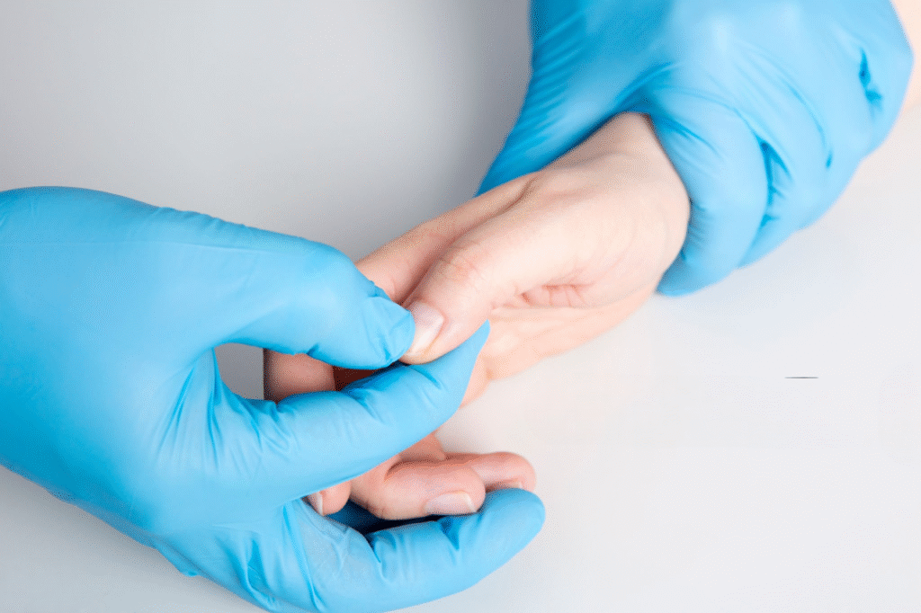 ongle fendu verticalement